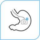 胃カメラ (経鼻内視鏡)