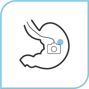 胃カメラ (経鼻内視鏡)